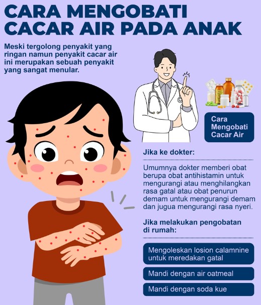 cacar air